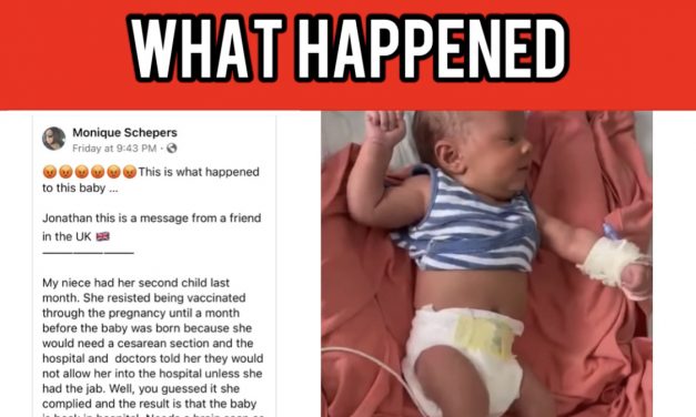 What happened to this baby?